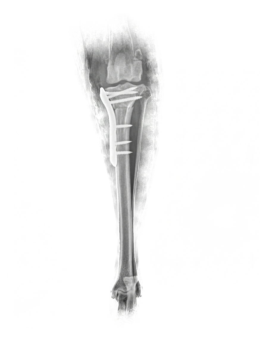 Radiografía posoperatoria de tibia con placa y tornillos