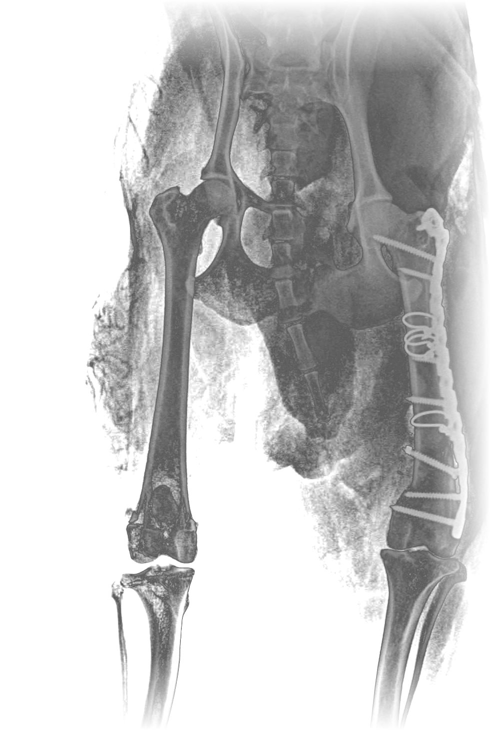 Radiografía de fémur izquierdo con placa de reconstrucción